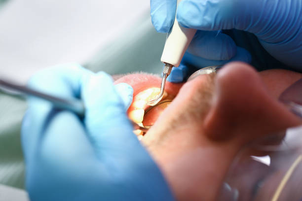 Best Emergency Treatment for Toothache in Dillon, MT